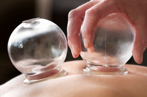 Cupping